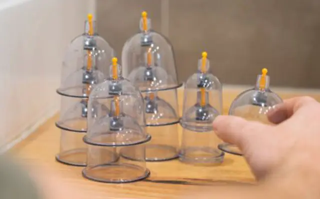 The cups used by our physiotherapists in cupping during our physiotherapy treatments